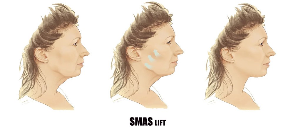 Estetik Cerrahide Nanoteknoloji Devrimi