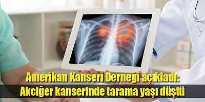 Amerikan Kanseri Derneği açıkladı; akciğer kanserinde tarama yaşı düştü