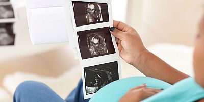 Anne ve Baba Adayları, Doğacak Çocuğunuzun Sağlığı Sizin Elinizde