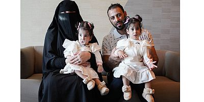 Başarıyla ayrılan Siyam ikizleri ülkeleri Cezayir'e dönüyor