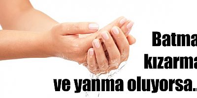 Batma, kızarma ve yanma oluyorsa…