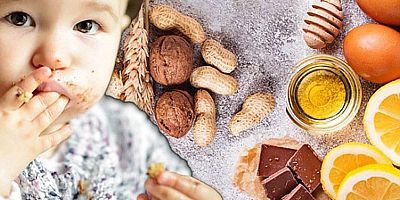 Bebeğiniz Kilo Alamıyorsa Nedeni Besin Alerjisi Olabilir