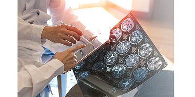 Bulanık Görme ve Güçsüzlük MS Belirtisi Olabilir