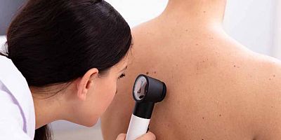 Cilt kanserine karşı koruma kalkanı oluşturarak önleminizi alın!