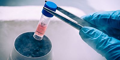 COVID–19 döneminde kök hücre bağışından vazgeçmeyin