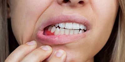 Denizci Hastalığı Türkiye’ye Geliyor 