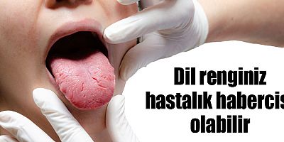 Dil renginiz hastalık habercisi olabilir