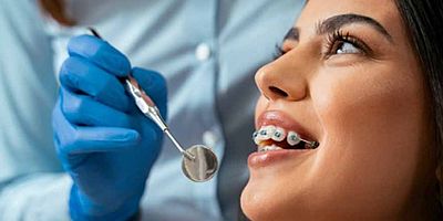 Düzelen Dişler Neden Tekrar Yer Değiştirir? Cevabı Pekiştirme Döneminde 