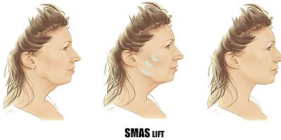 Estetik Cerrahide Nanoteknoloji Devrimi