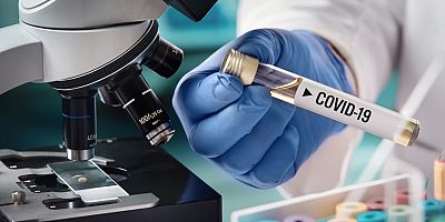 Farkında Olmadan Koronavirüs Geçirip Geçirmediğinizi Test Yaptırarak Öğrenebilirsiniz