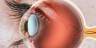 Geç kalınan her süre kalıcı hasar oluşma riskini artırıyor