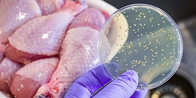 Gıda Zehirlenmesinde Erken Müdahale Tedaviyi Kolaylaştırıyor