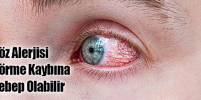 Göz Alerjisi Görme Kaybına Sebep Olabilir
