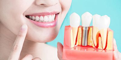 Güzel bir gülüşe sahip olmak özgüveni artırıyor