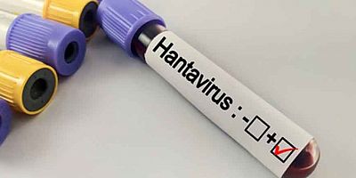 Hantavirüs Bir Salgına Dönüşür mü?