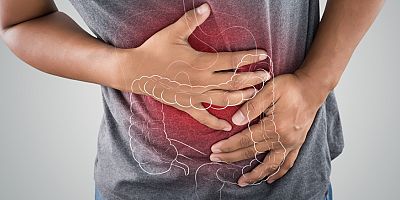 Huzursuz Bağırsak Sendromu FODMAP Diyeti ile Tedavi Edilebilir mi?