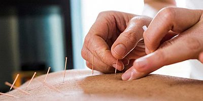 İğne Küçük ama Etkisi Büyük ... 100 ‘ün Üzerinde Sağlık Sorununun Tedavisinde Kullanılıyor