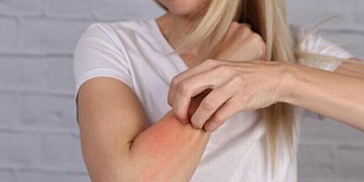 İlaç almam gerek. Ya alerjim varsa!