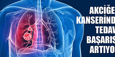 İleri evre akciğer kanserinde umut artıyor!