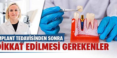 İmplant Tedavisinden Sonra Dikkat Edilmesi Gerekenler 