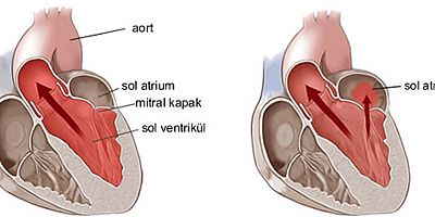 Kalbin içindeki mucize: Mitral kapak
