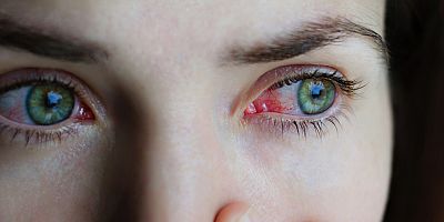 Körlüğün yüzde 80'i önlenebilir nedenlere bağlı...