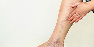 Koronadan kaçarken varise yakalanmayın