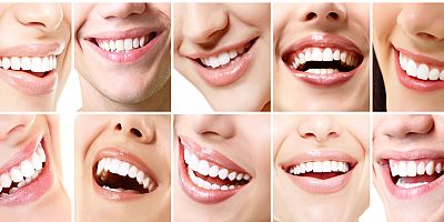 Kusursuz gülümsemenin şifresi