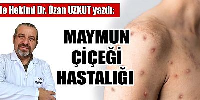 MAYMUN ÇİÇEĞİ HASTALIĞI