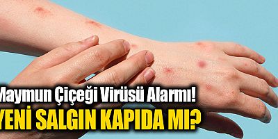 Maymun Çiçeği Virüsü Alarmı! YENİ SALGIN KAPIDA MI?