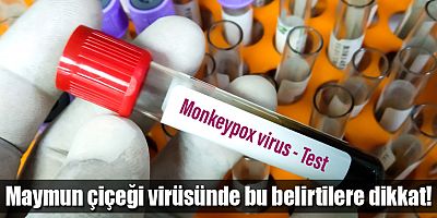 Maymun çiçeği virüsü hakkında bilinmesi gereken 5 nokta!