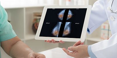 Meme İçin Hangi Görüntüleme Yöntemi, Ne Zaman Kullanılmalı?