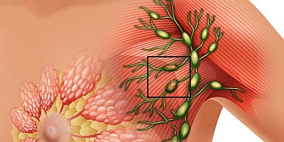 Meme Kanseri çocuk sahibi olmaya engel mi?