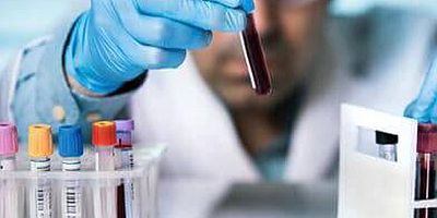 Moleküler Alerji Testi İle Alerjik Şok (Anafilaksi) Nedenleri Çok Ayrıntılı Ortaya Çıkarılabilir