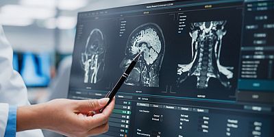 Plastikten Özgür Bir Gelecek: Beynimizi ve Dünyamızı Koruyalım!