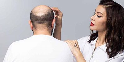 Saç ekiminde “erken yaş” faktörüne dikkat!