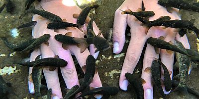 Sedef hastalığına “balıklar “ şifa oluyor