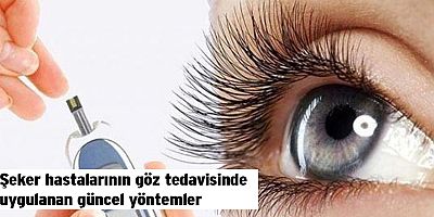 Şeker hastalarının göz tedavisinde uygulanan güncel yöntemler
