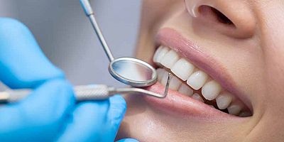 Sigara, kola ve çay diş sararmasını tetikliyor