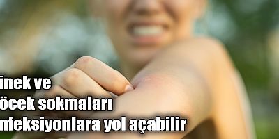Sinek ve böcek sokmaları enfeksiyonlara yol açabilir