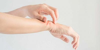 Soğuk Havalarda Egzamaya Dikkat!