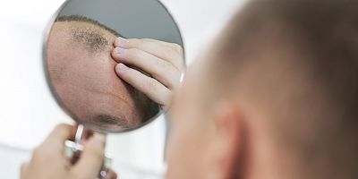 Sosyal Medya Filtreleri Güzellik Algısını Saç Ekimine Yönlendirdi!