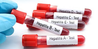 Tedavi Edilmeyen Hepatit Ölümcül Olabiliyor!