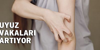 Uyuz vakaları artıyor