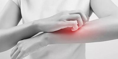 Uyuz vakalarında artış var