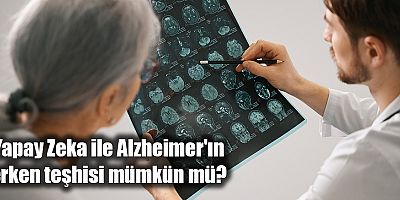 Yapay Zeka ile Alzheimer'ın Erken Teşhisi Mümkün Mü?