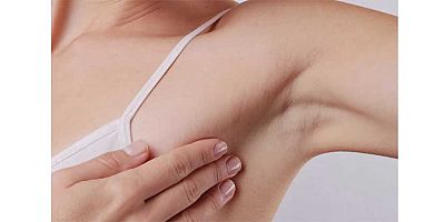 Yaz Aylarında Aşırı Terleme ve Botoks Tedavisi