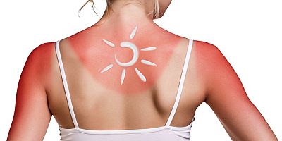 Yaz aylarının zararlı mirası; Güneş lekeleri