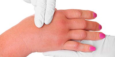 Yazın Uçan Tehlikesi