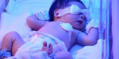 Yeni doğan döneminde sarılığa dikkat!